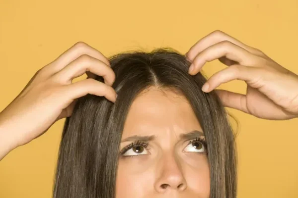 How to cure itchy scalp Ready to restore and nourish hair to be strong. not easy to fall off